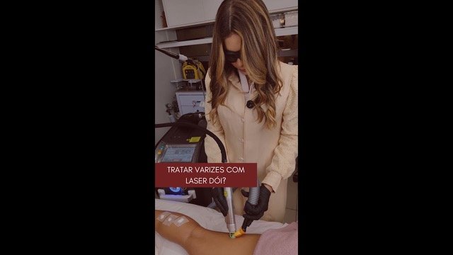 Vídeo: Tratar varizes com laser dói?